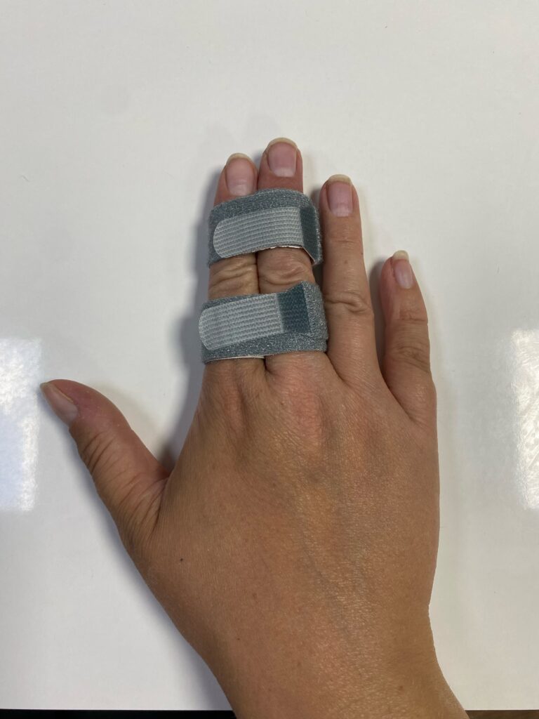 Hand Therapy Harley Clinic