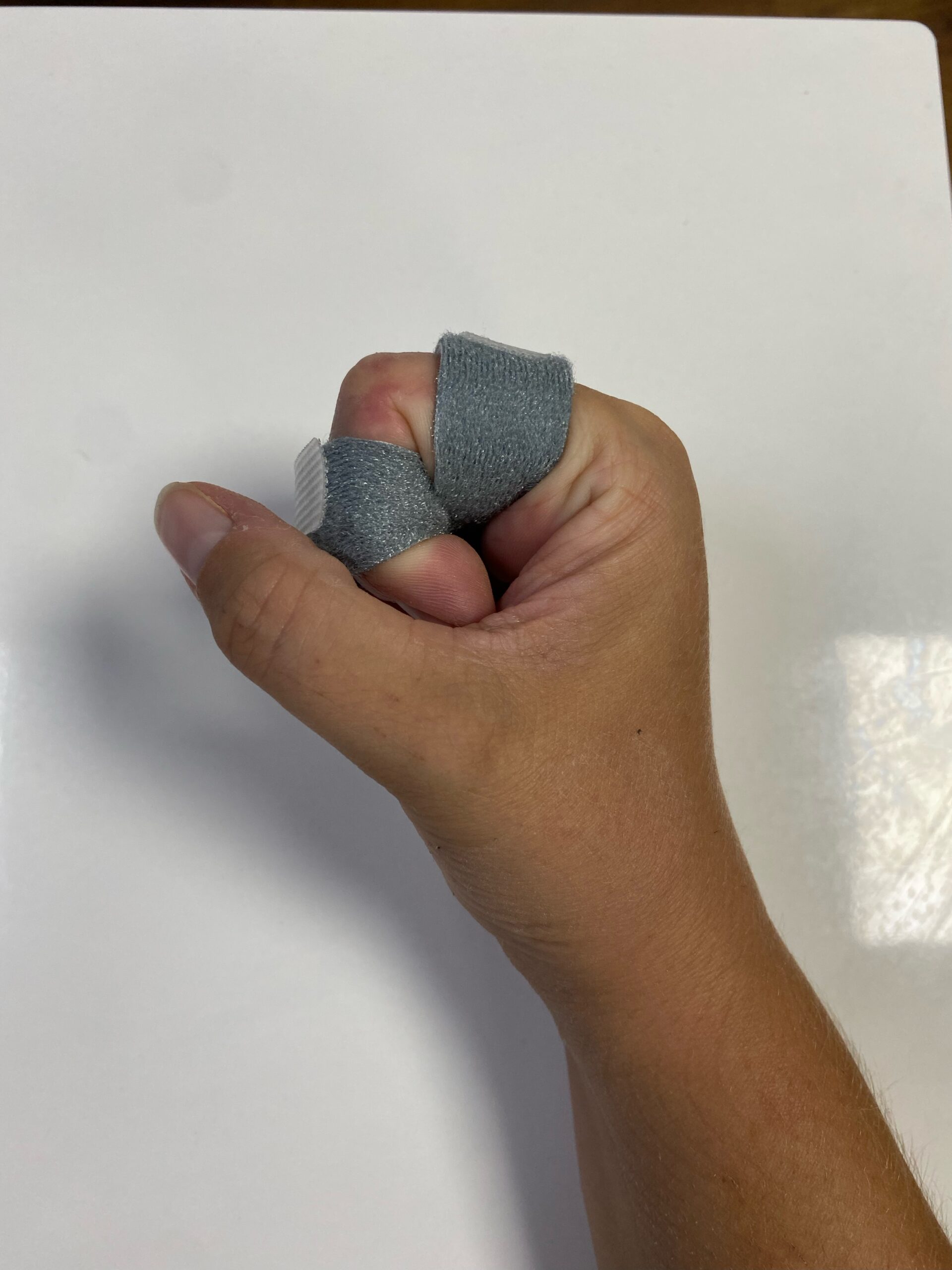 Hand Therapy Harley Clinic