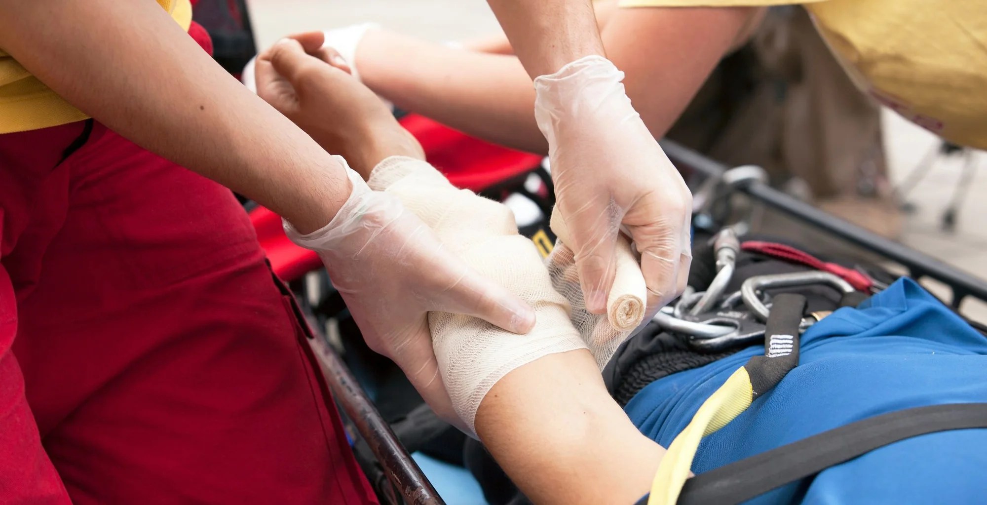 Burn Care Essential First Aid Treatment and SelfCare Guidelines