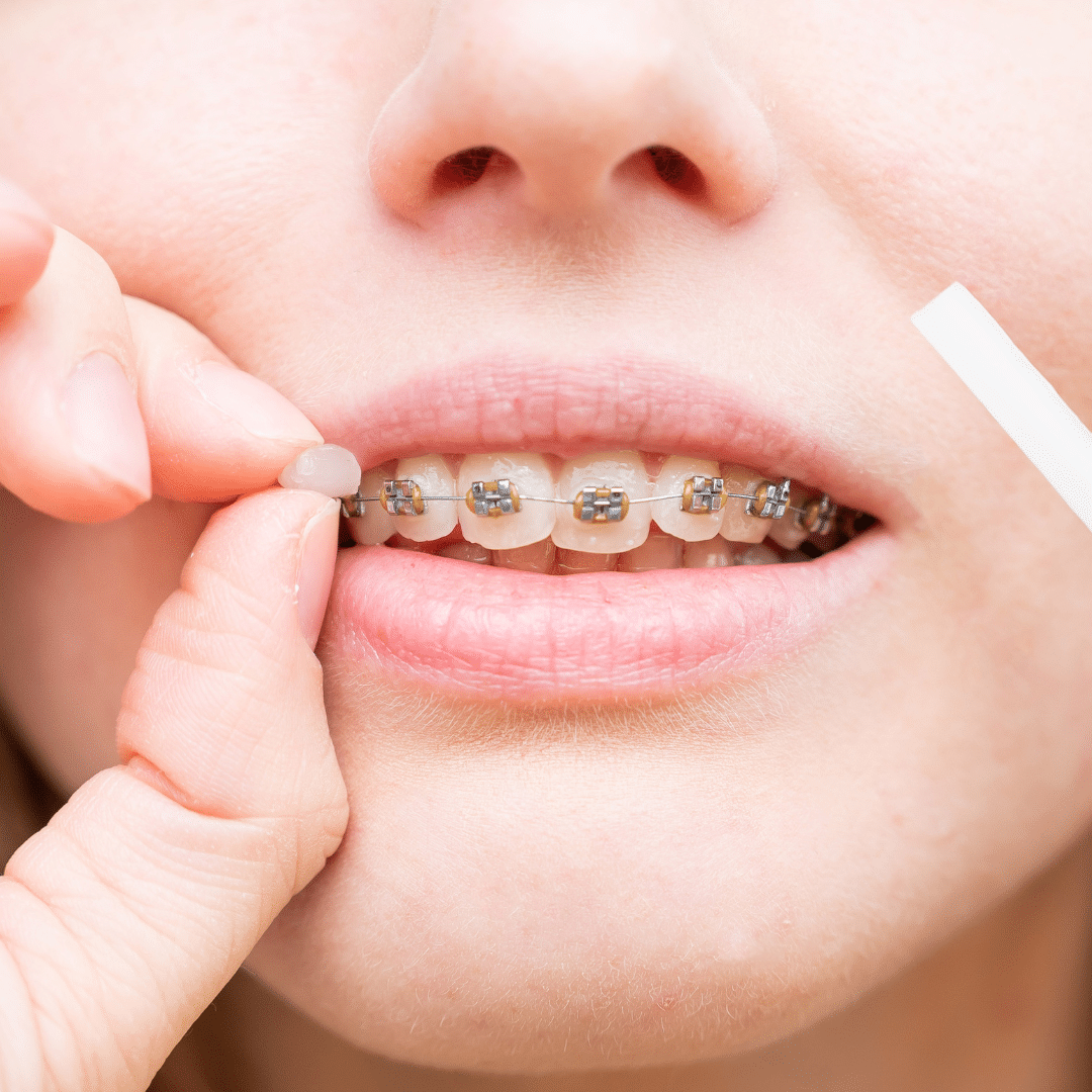 A Dental First Aid Kit Every Home Should Own Harmony Dental Studio