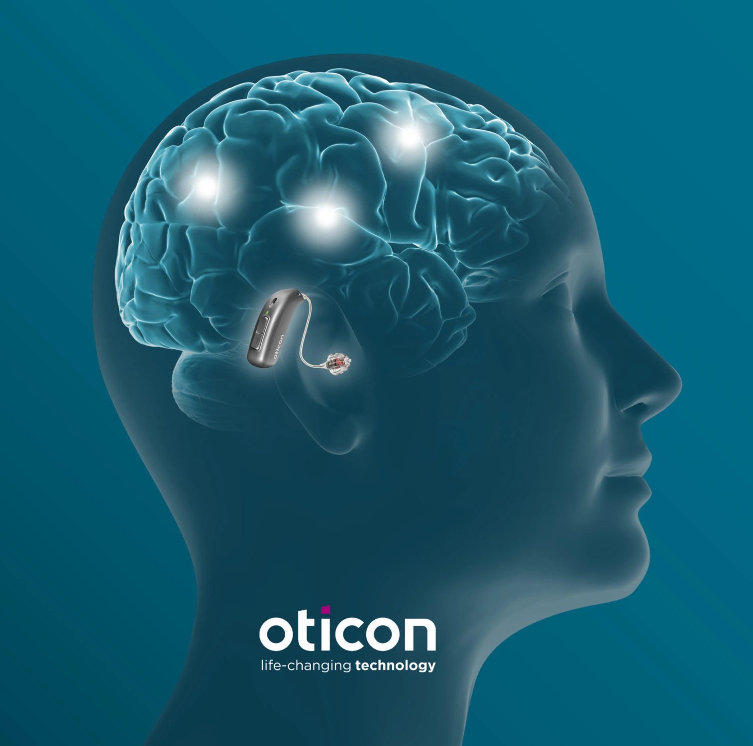 Oticon Hearing Aids | Elevate Your Listening