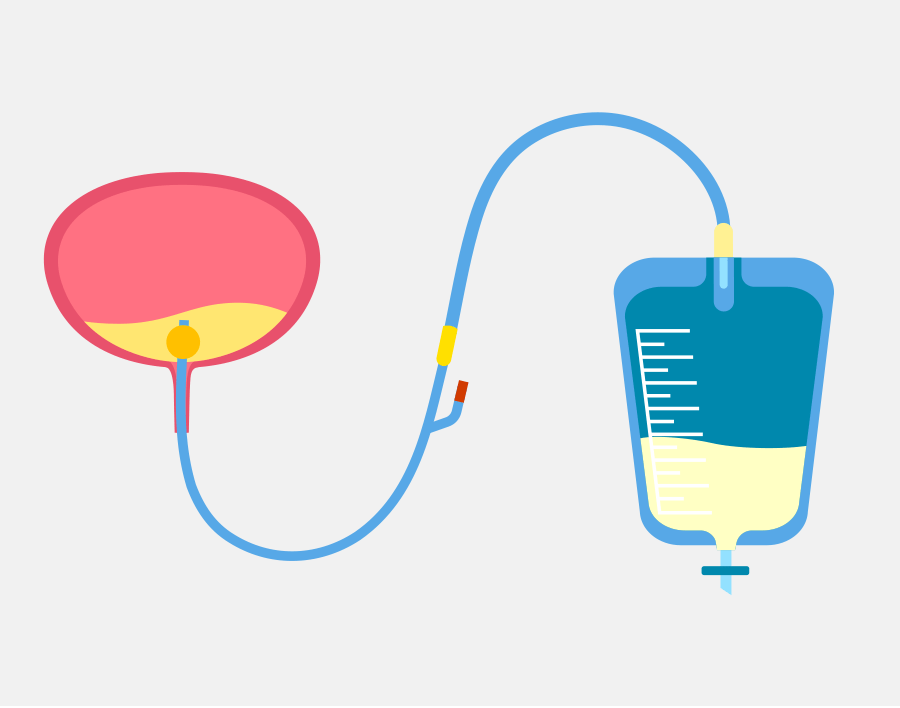 Update more than 132 foley catheter bag change esthdonghoadian