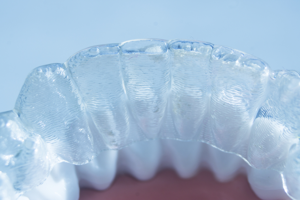 Invisible clear aligners for teeth HCI Dentistry Hermitage, TN