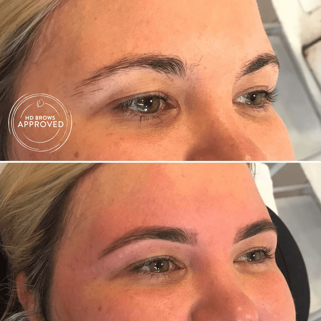 Before & Afters HD Brows®