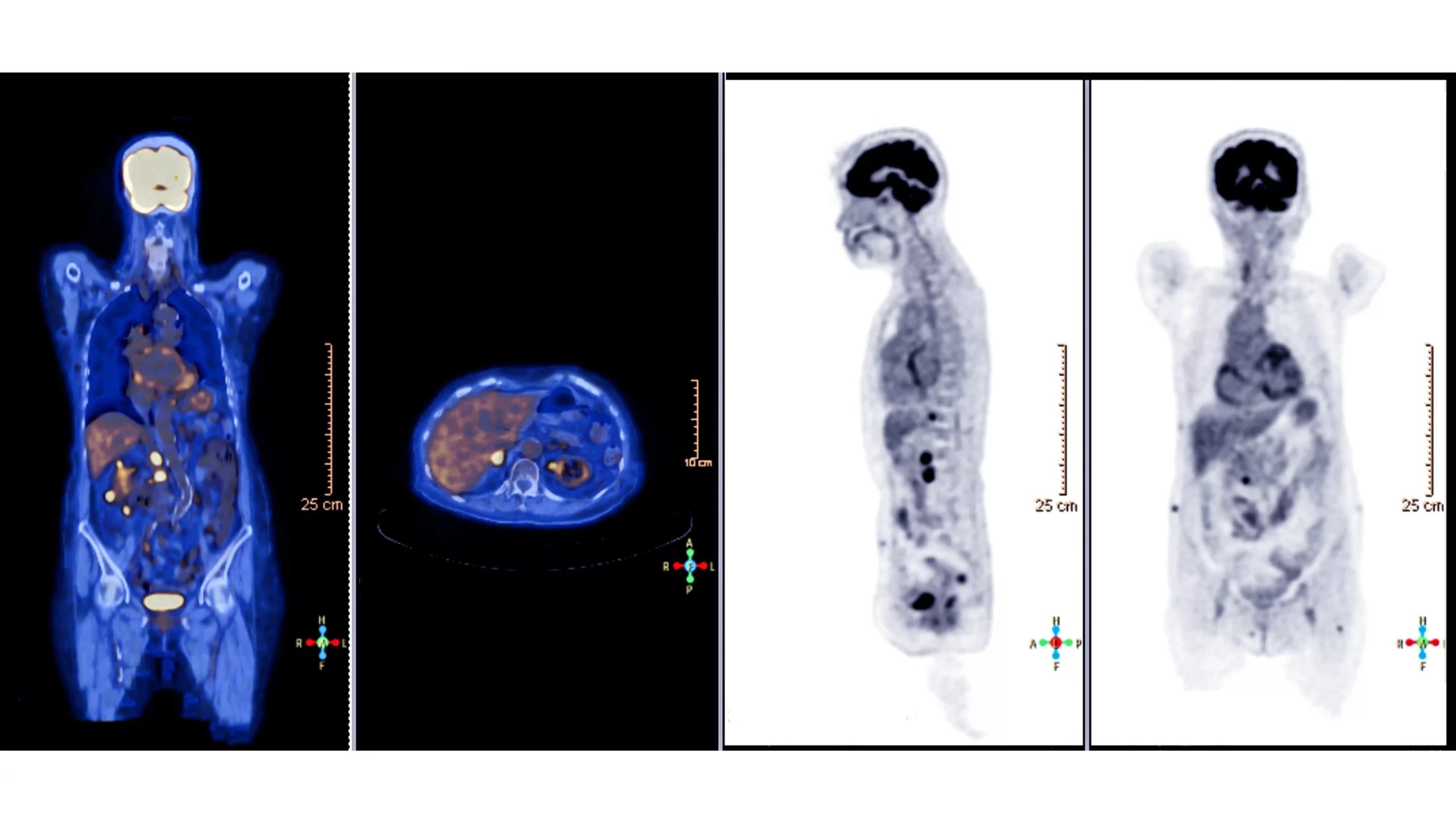 What Should You Expect When Getting a PET Scan? Hollywood Diagnostics