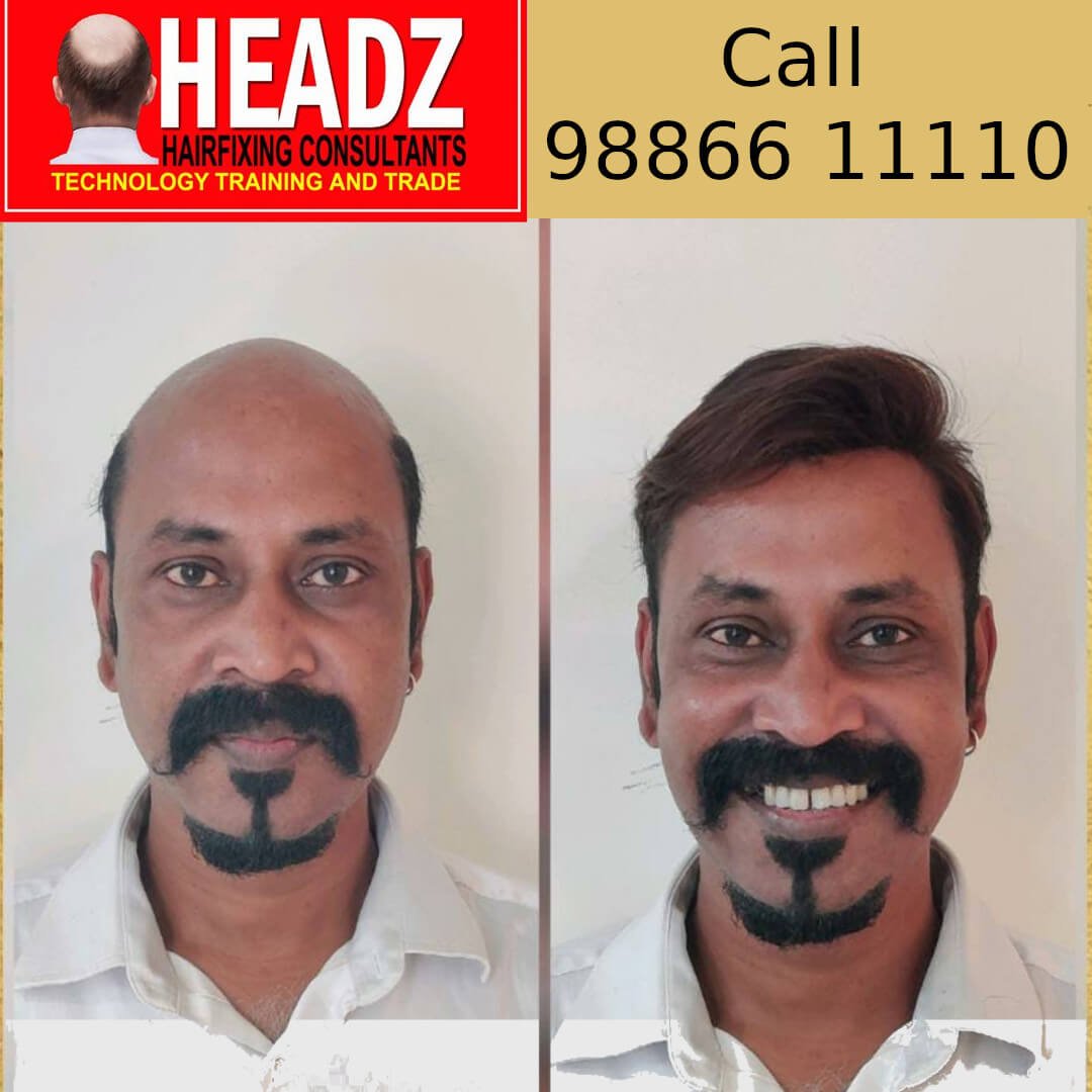 Before and After Hair Fixing Photos Headz Hair Fixing