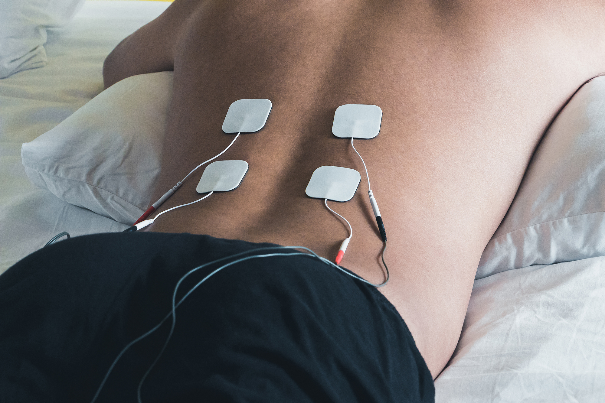 What is a TENS Unit? + How to Use & How Does it Work SelfDecode Health