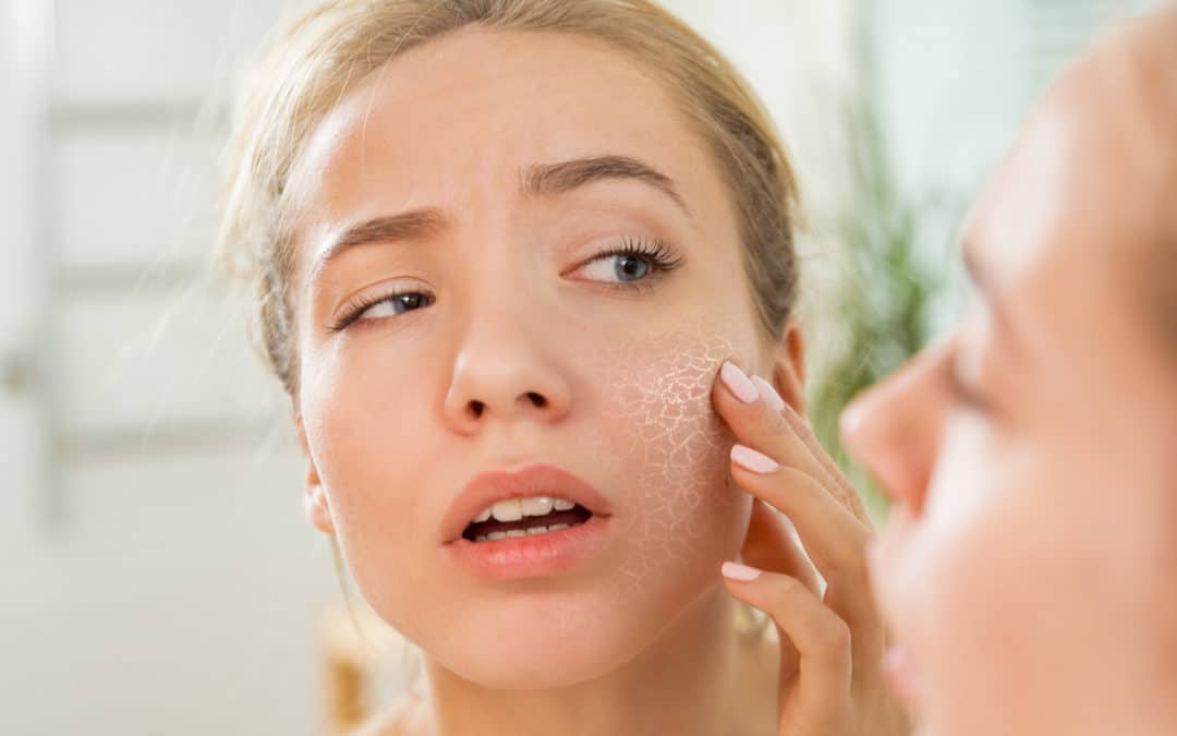 Dry Skin Risk Factors and Treatments