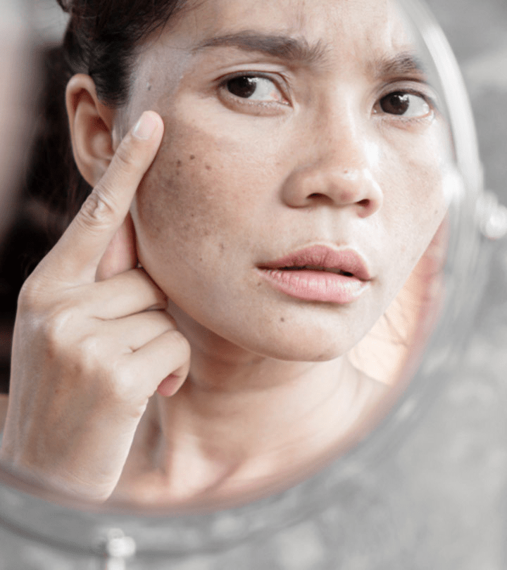 How To Remove Sunspots Naturally