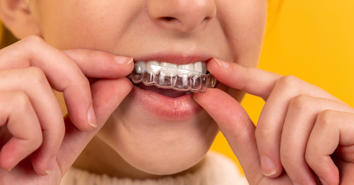 Can Braces or Aligners Help for TMJ Disorders? Health Blogster