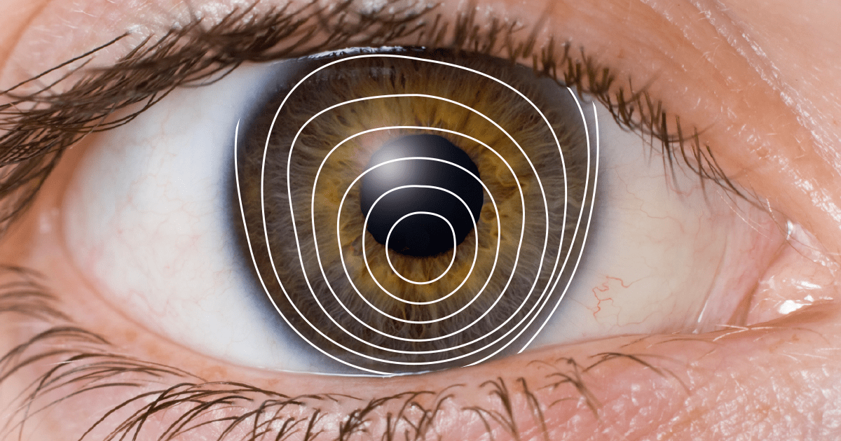 What Are The Most Effective Treatments For Keratoconus? Health Cautions