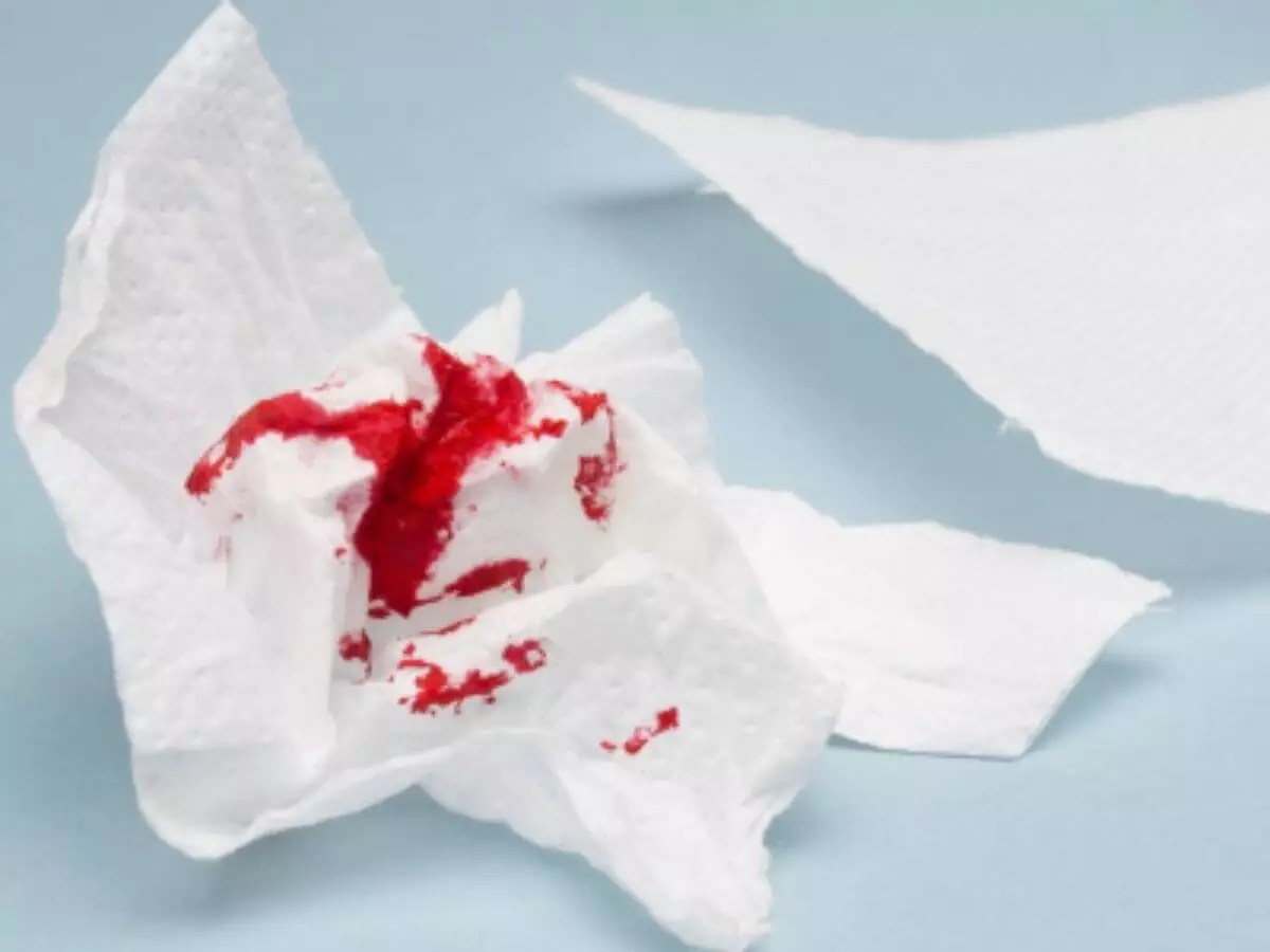 What Are The Causes Of Bloody Stools? Health E Happy