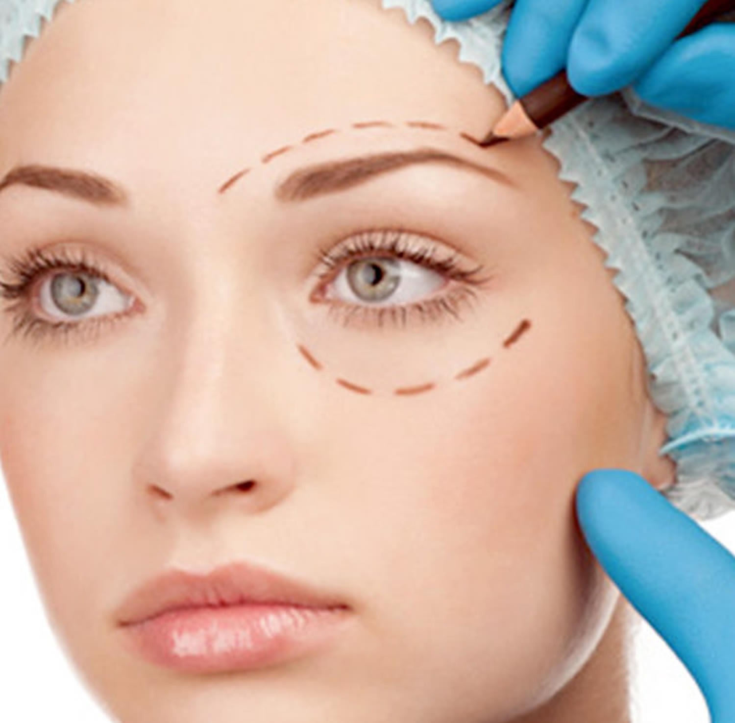 Eyelid Surgery Upper & Lower, Blepharoplasty Surgery