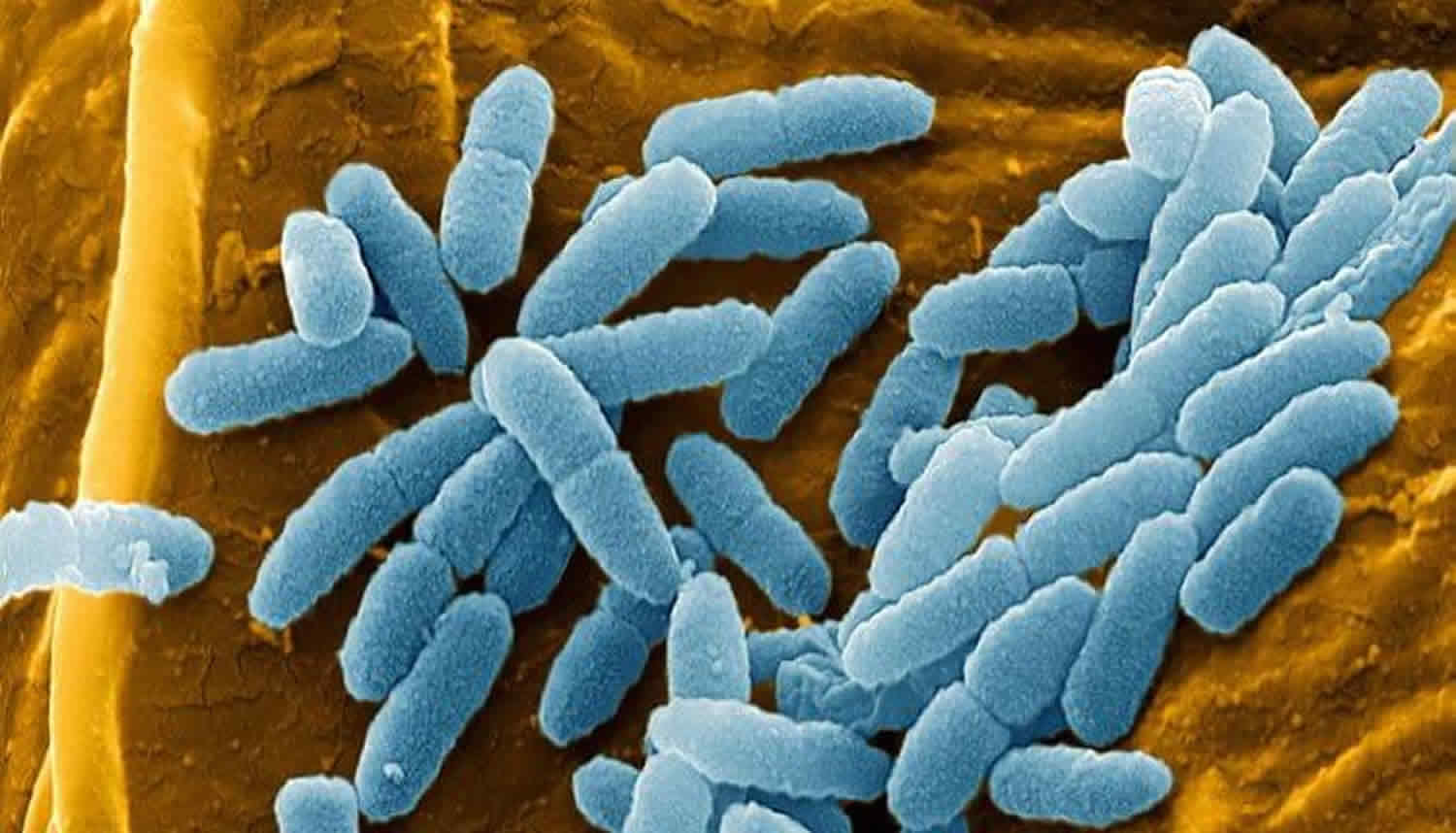 Pseudomonas & pseudomonas aeruginosa infections and treatment