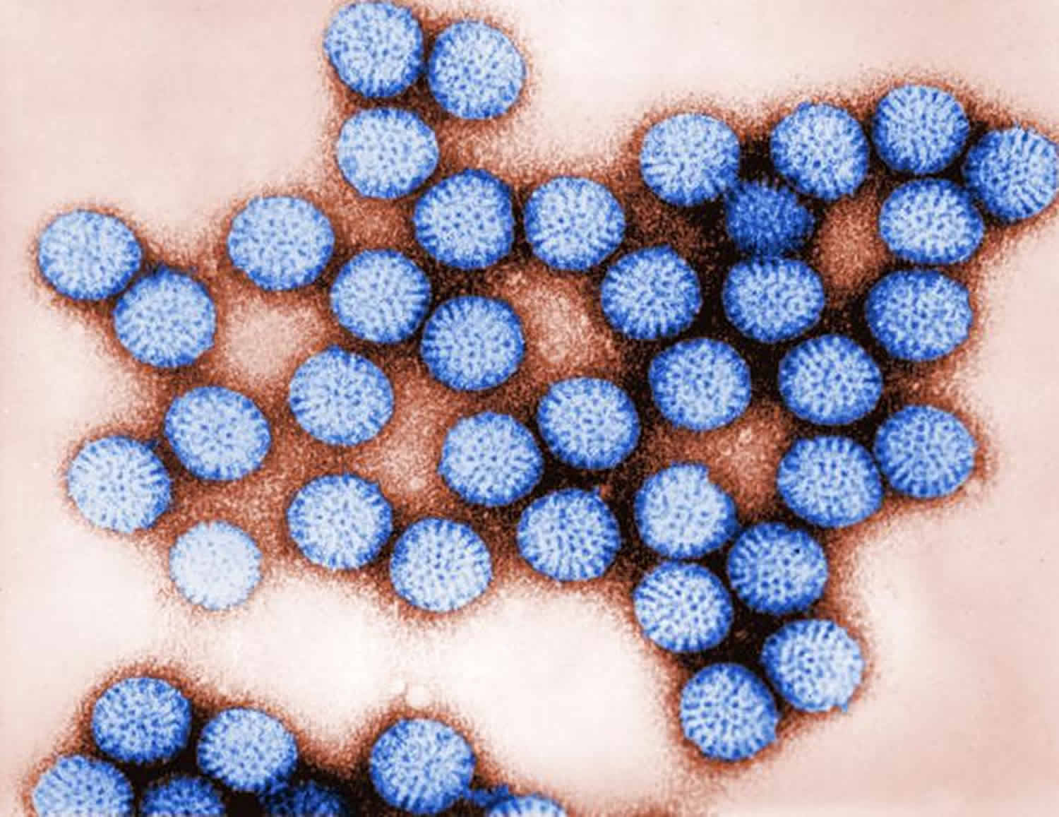 Rotavirus transmission, rotavirus infection symptoms, vaccine & treatment