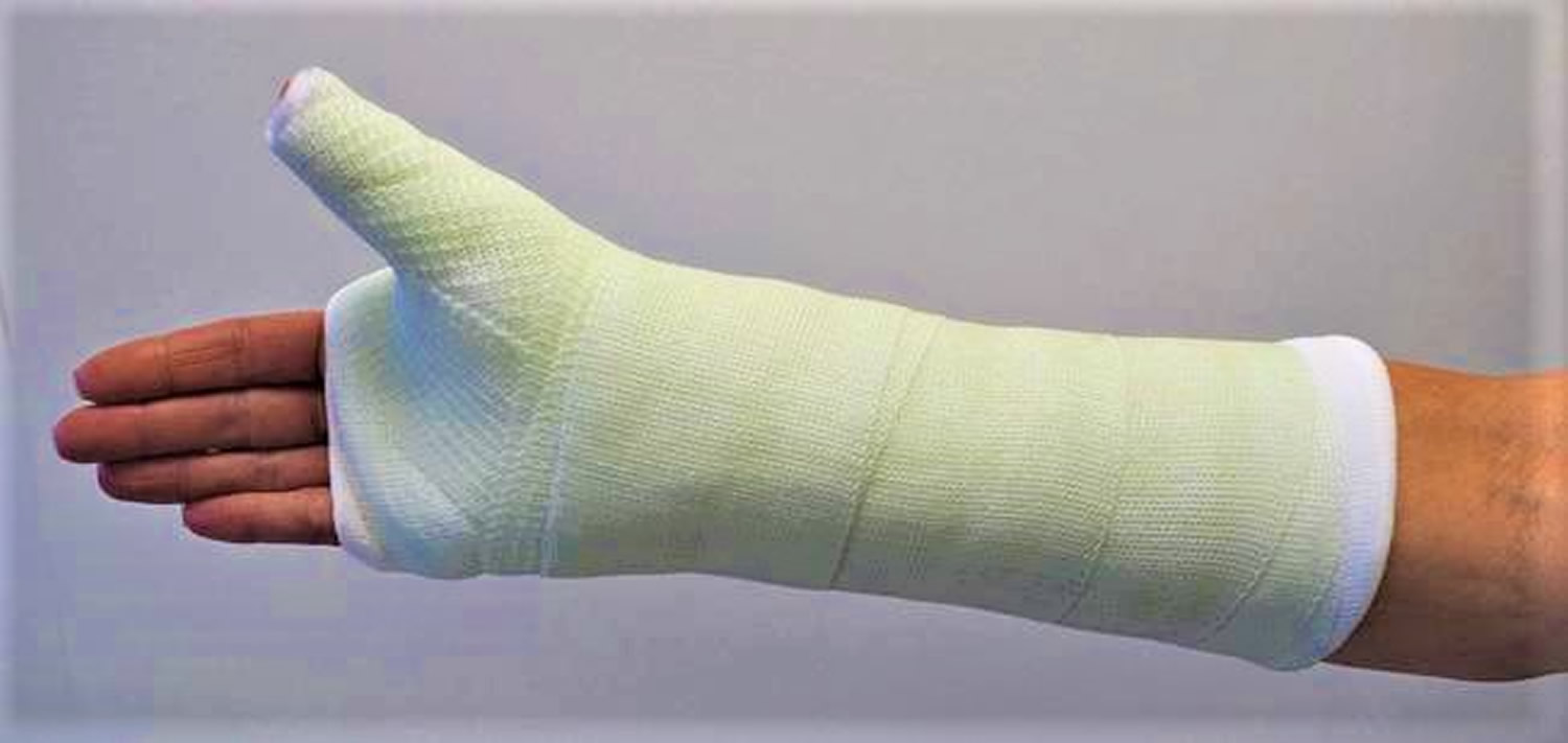 Scaphoid fracture causes, symptoms, diagnosis, treatment & revovery time