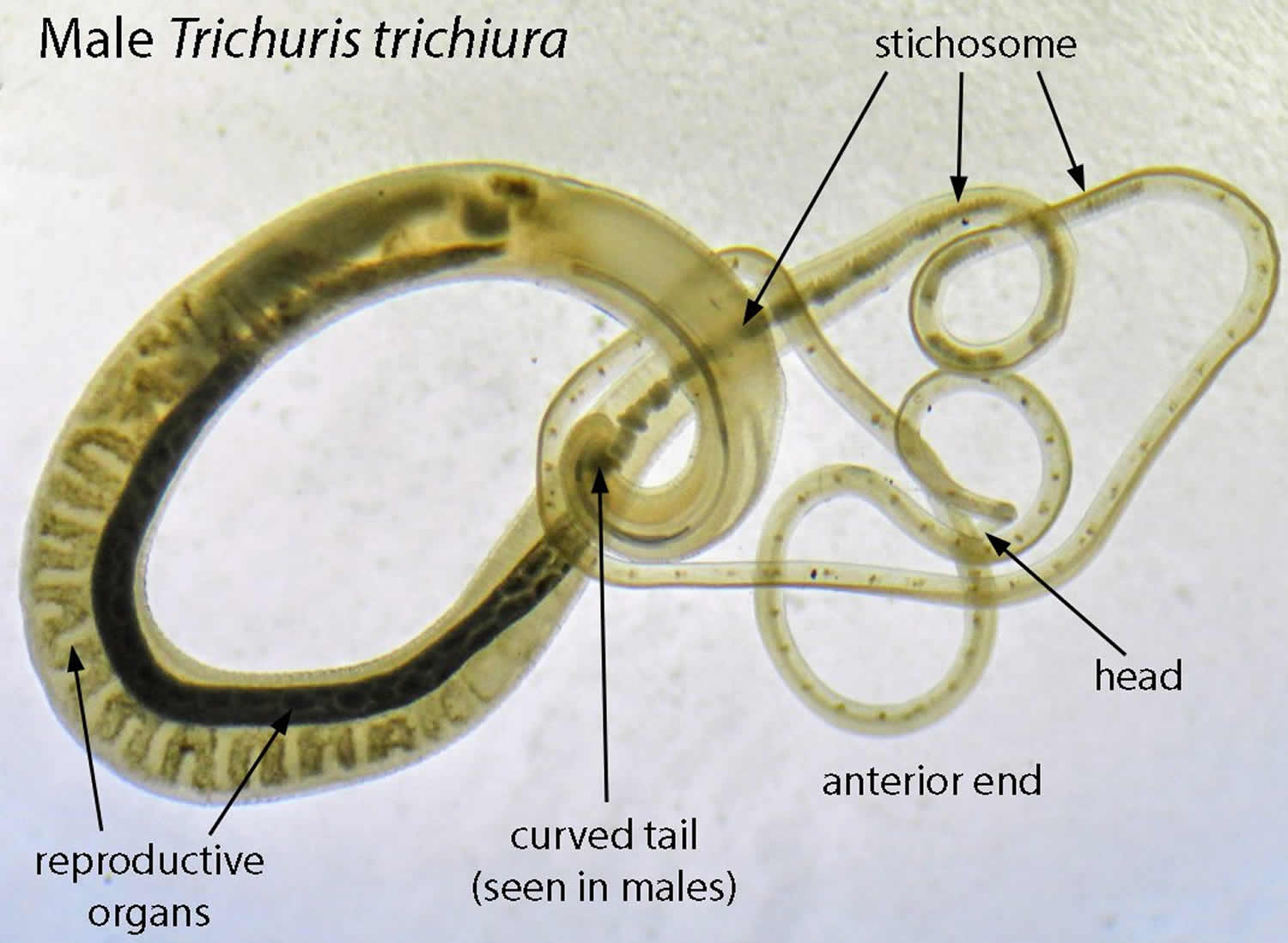 Whipworm in humans symptoms, prevention, diagnosis & whipworm treatment