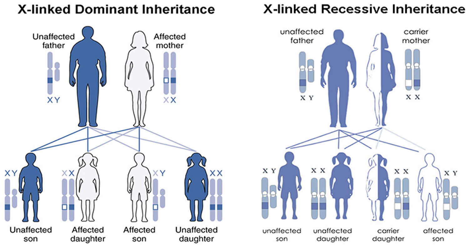 MECP2 duplication syndrome causes, symptoms, diagnosis, treatment & prognosis