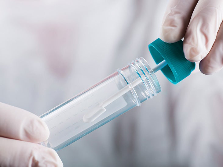 Ulcerative Colitis New Guidelines For Testing Stool And Blood Tests