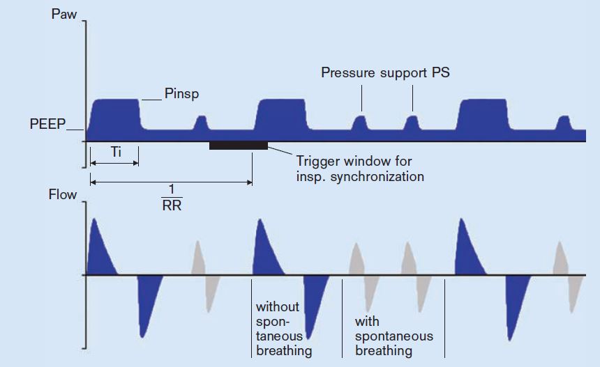 Anesthesia Gas Machine Ventilators