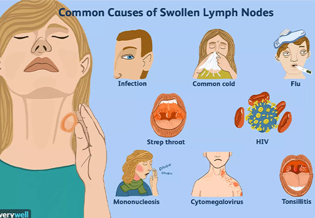 How COVID19 vaccine might affect your mammogram result Healthwise