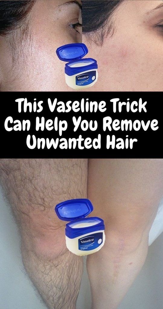 This Vaseline Trick Can Help You Remove Unwanted Hair Healthy