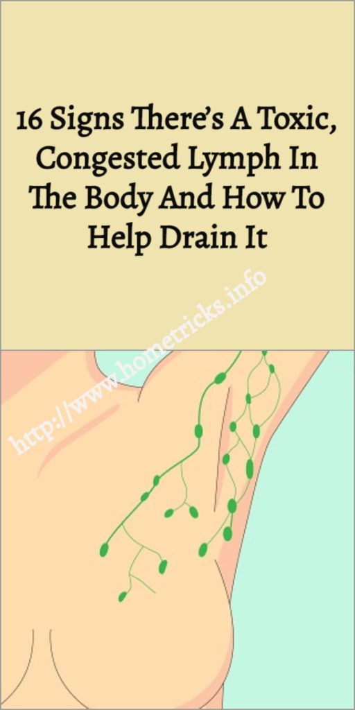 16 Signs There’s A Toxic, Congested Lymph In The Body And How To Help
