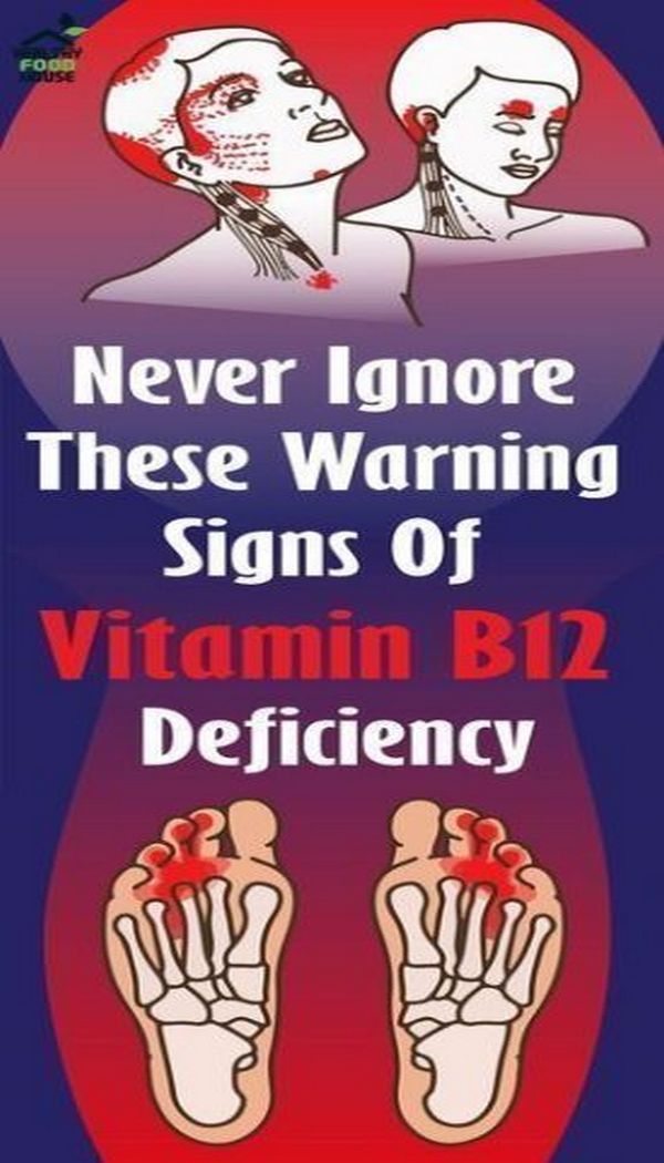 Never Ignore These Warning Signs of Vitamin B12 Deficiency Healthy