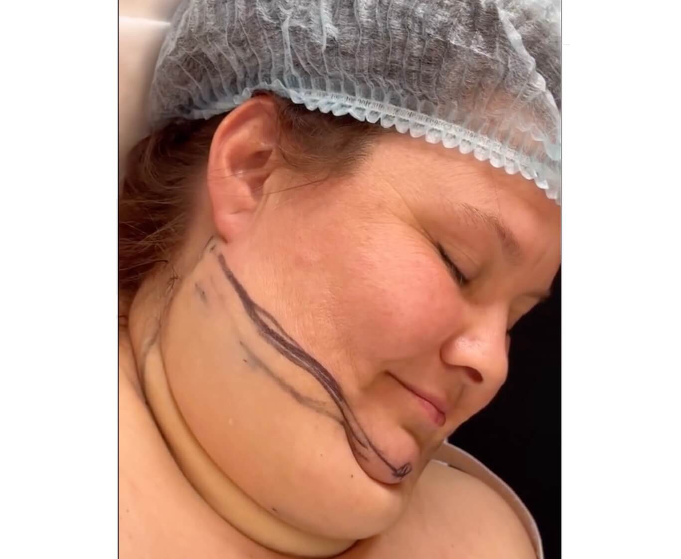 Her Transformation After This Simple Procedure Is Absolutely Jaw