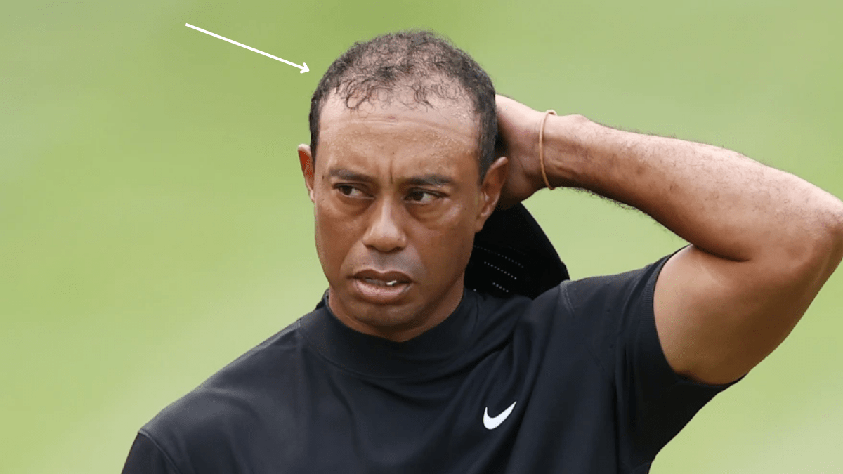 A Detailed Look into Tiger Woods Hair History Heartafact