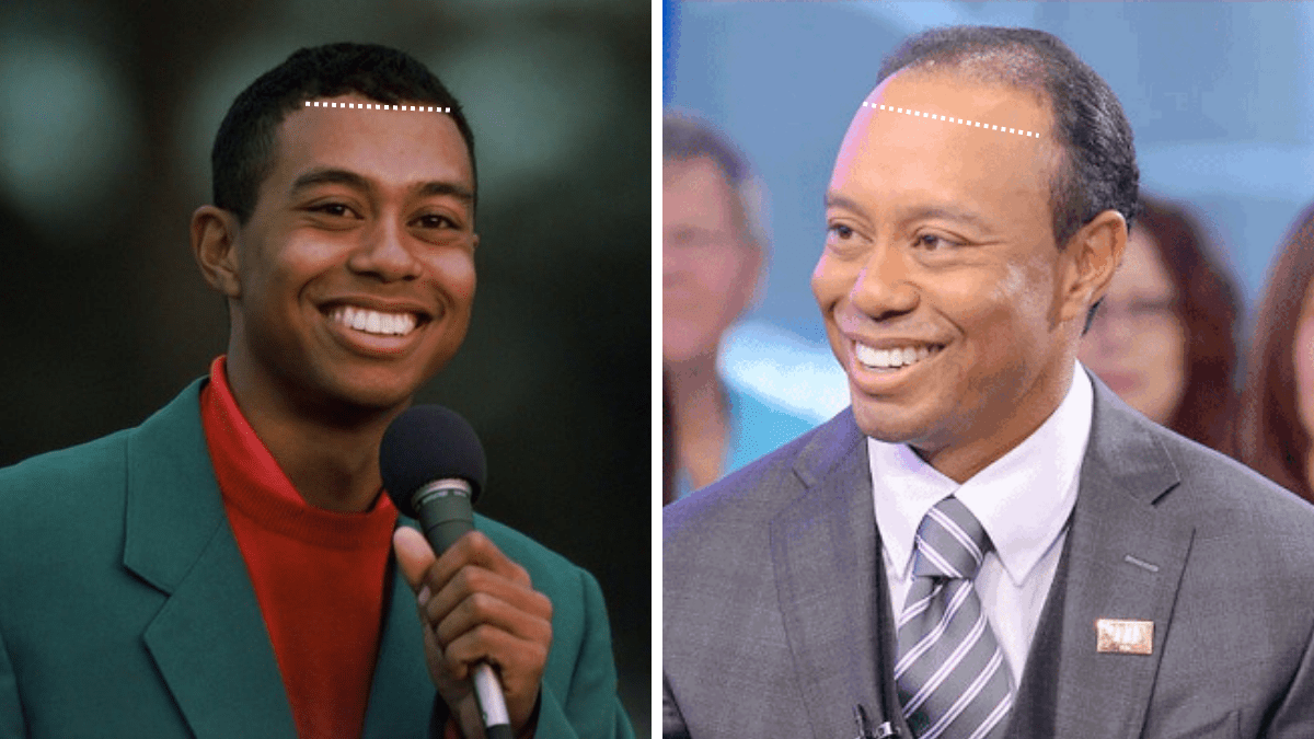 A Detailed Look into Tiger Woods Hair History Heartafact