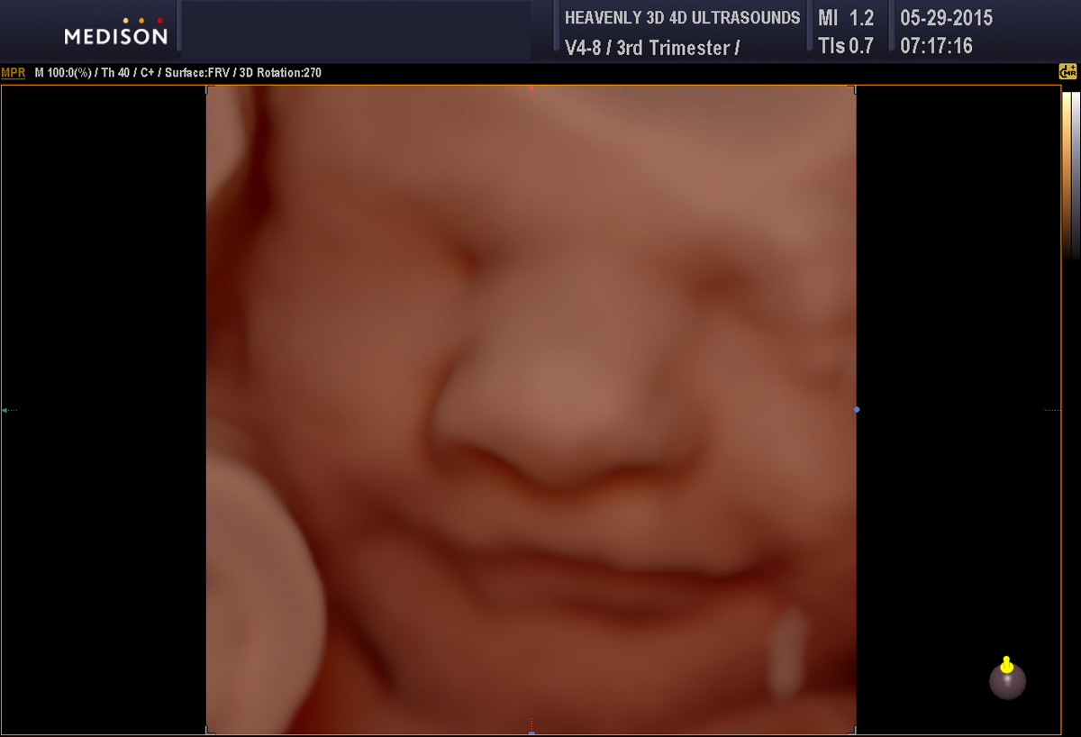 3d 4d Image Gallery Heavenly Ultrasound