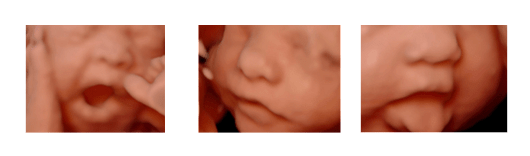 Heavenly 3D 4D Ultrasound Baby 3D Ultrasound 4D Ultrasound in Apple