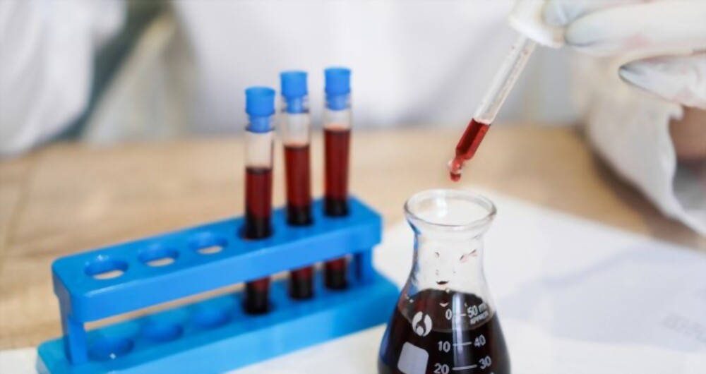 10 Essential Blood Tests Everyone Should Get Regularly Helix Path Labs