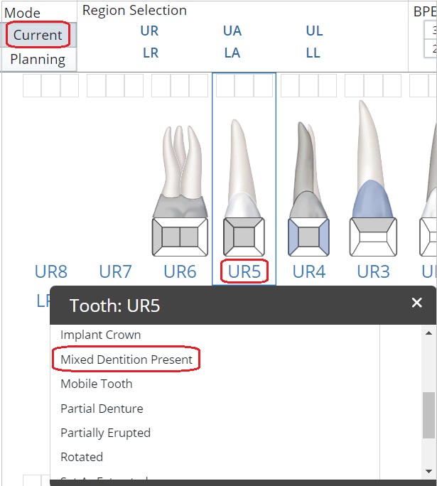How to Chart Mixed Dentition Carestream Dental
