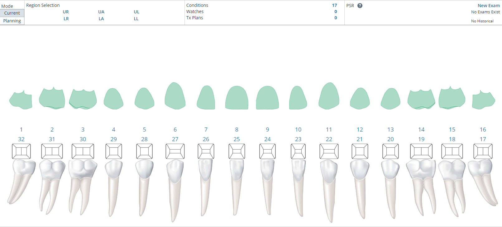 How to Chart Existing Dentures Carestream Dental