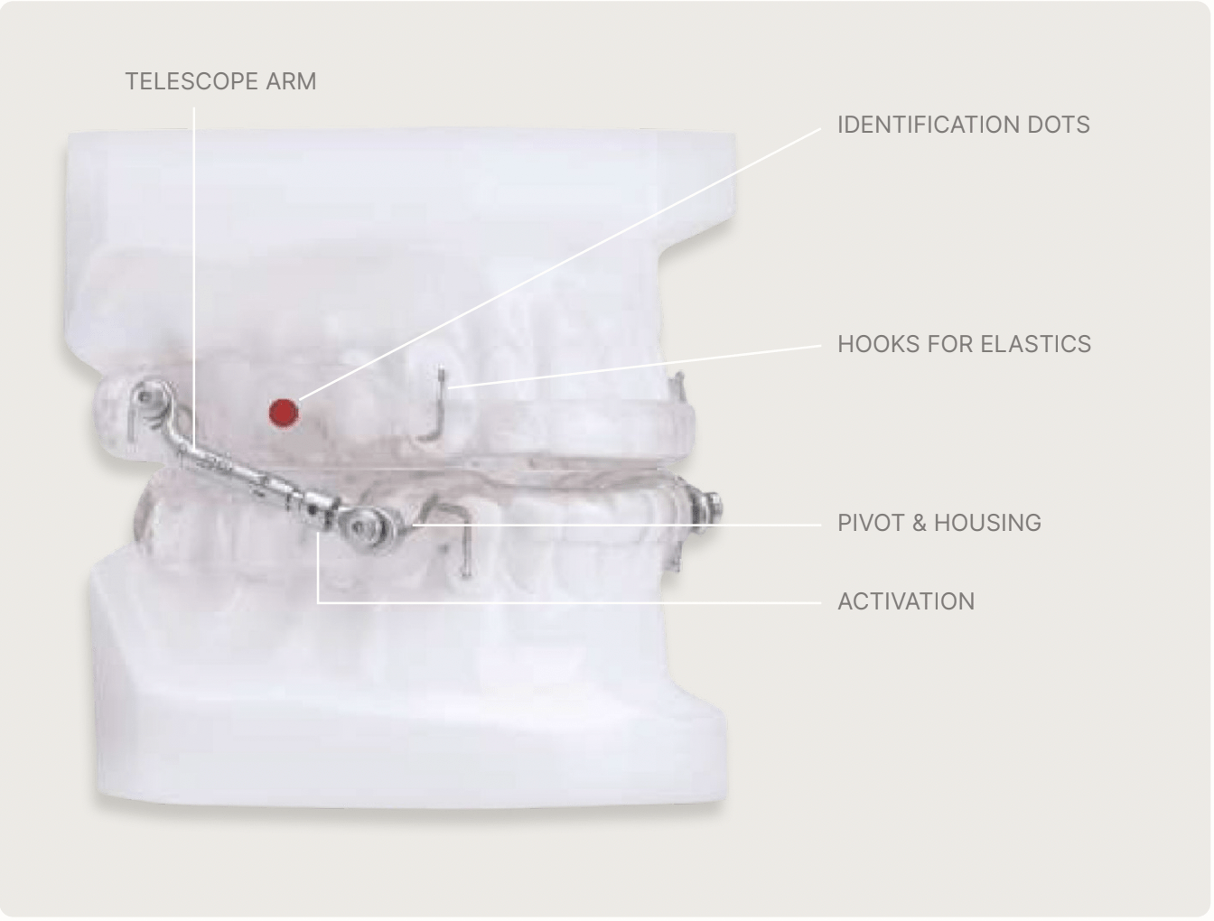 Maintaining and Adjusting a Herbst Appliance Dandy