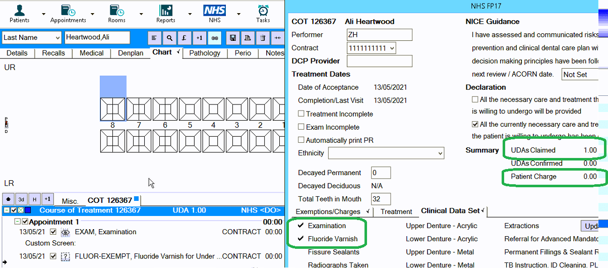 NHS Wales £0 Fluoride Varnish Charge for Under 25 / Over 60 Patients