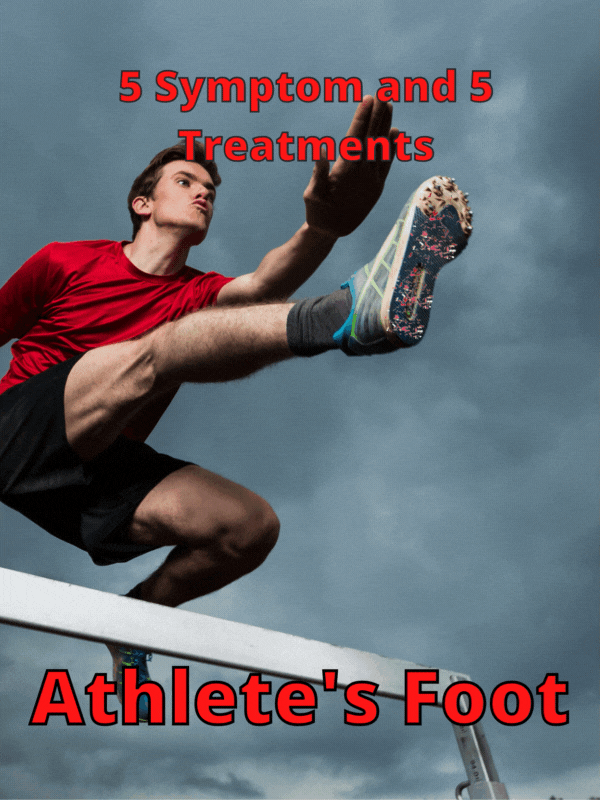 Athlete’s Foot [5 Symptoms and 5 Treatments]