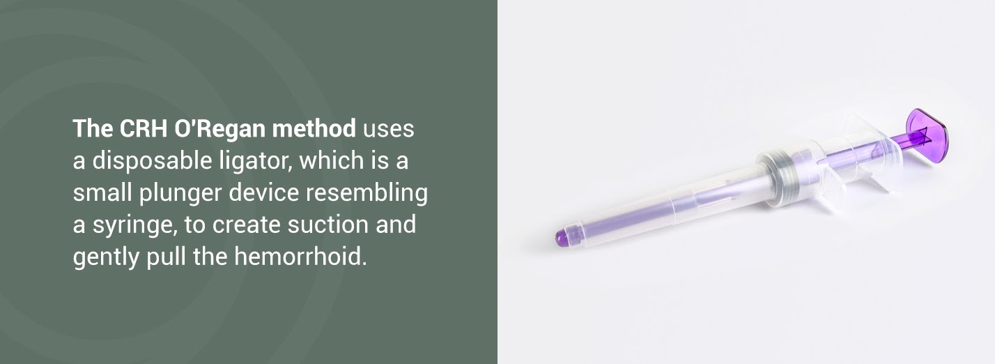 Hemorrhoid Banding Procedure Near Me at Stephanie Tart blog