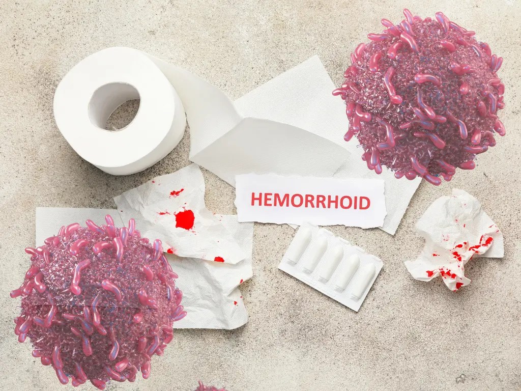 Anal Cancer vs. Hemorrhoids