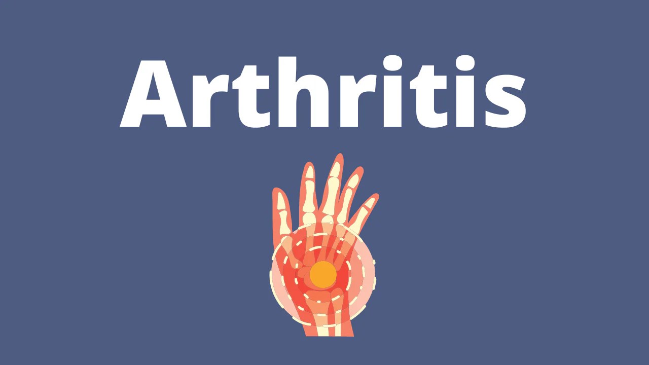 Arthritis CBD Specialist HempSapa®