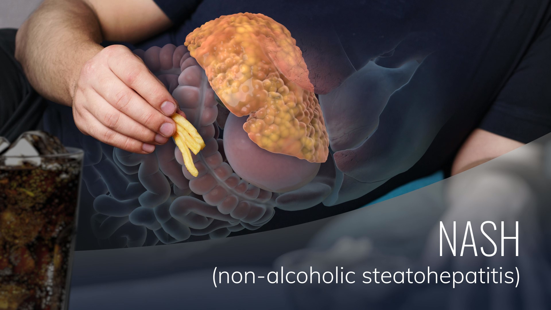 Rencofilstat Overview Hepion Pharmaceuticals