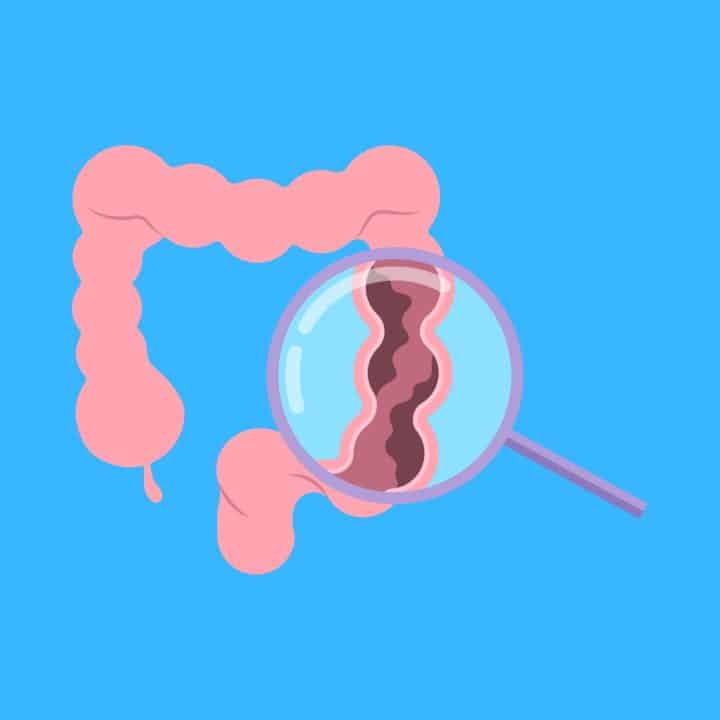 30 Funny Colonoscopy Jokes Here's a Joke