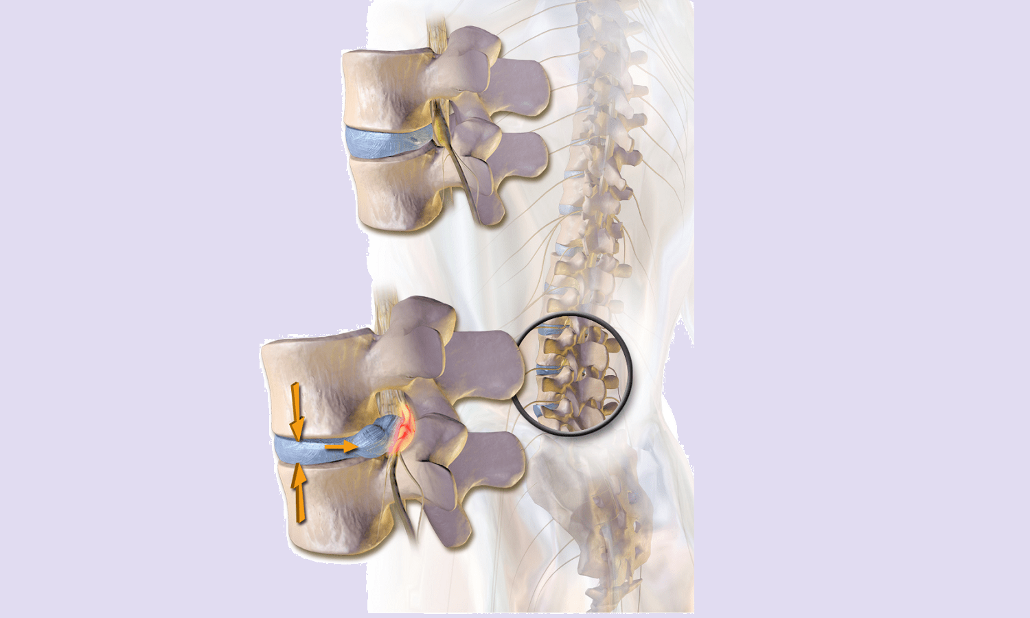 Herman & Wallace Pelvic Rehabilitation Continuing Education Finding