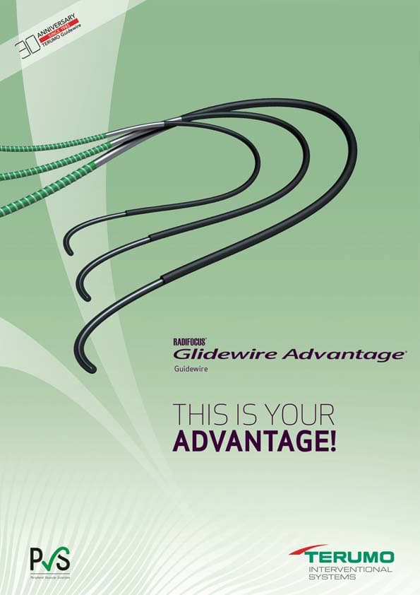 Complex calcified lesions of the femoropopliteal artery endovascular