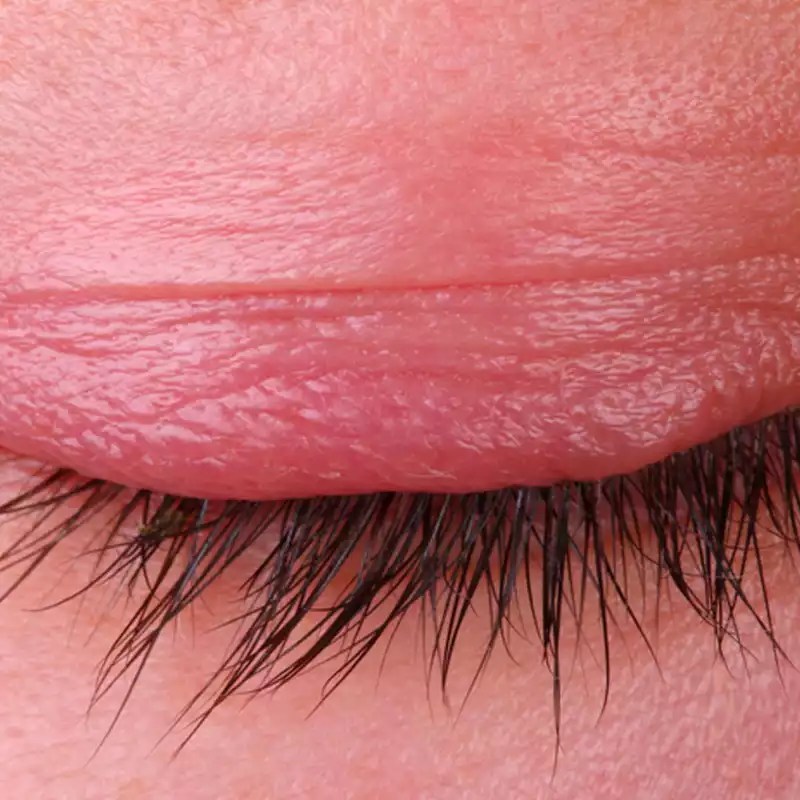 Why Are My Eyelashes Itchy How to Prevent Lash Extension Itch?