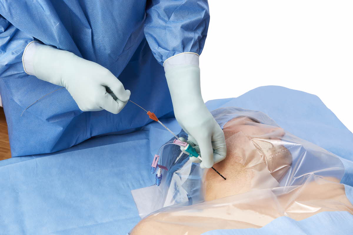 Vascular Access Management Introduction to Central Venous Catheters (1