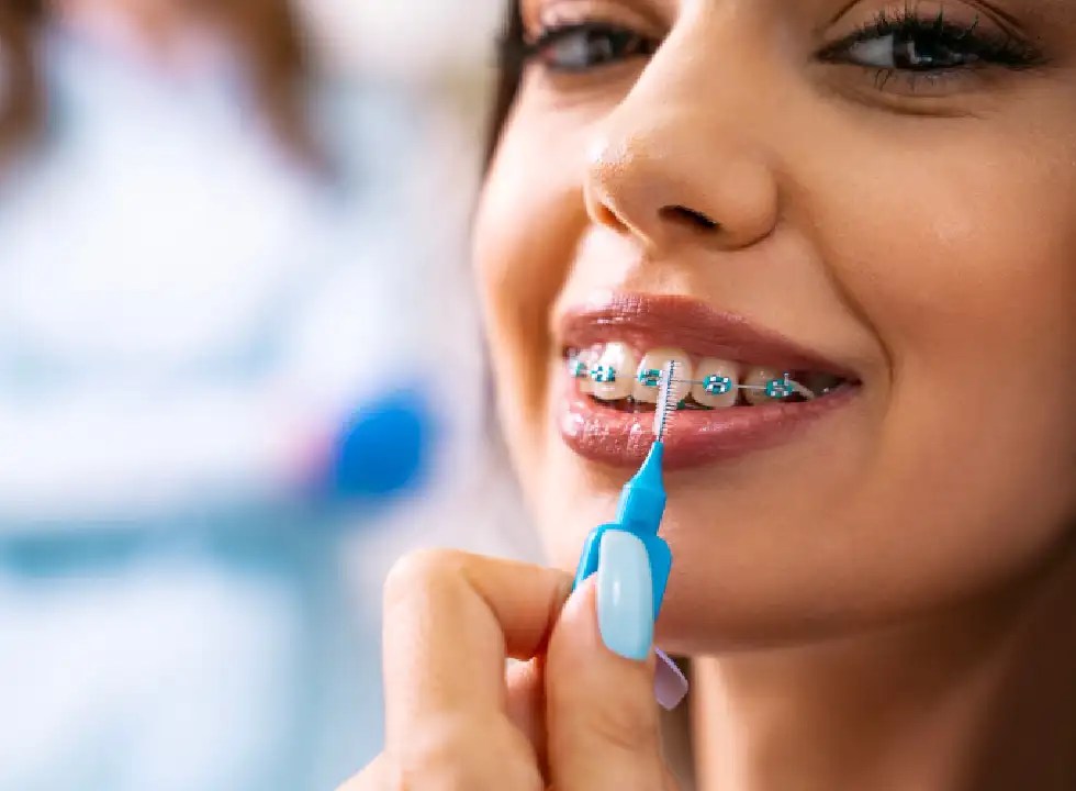 Invisalign Braces Braces Abu Dhabi Best Orthodontist in Abu Dhabi