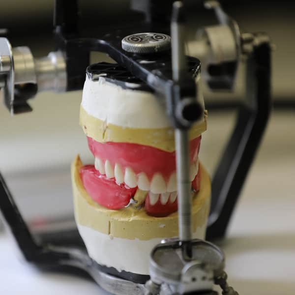 Denture Clinic in Calgary NW Kensington Hillhurst Denture